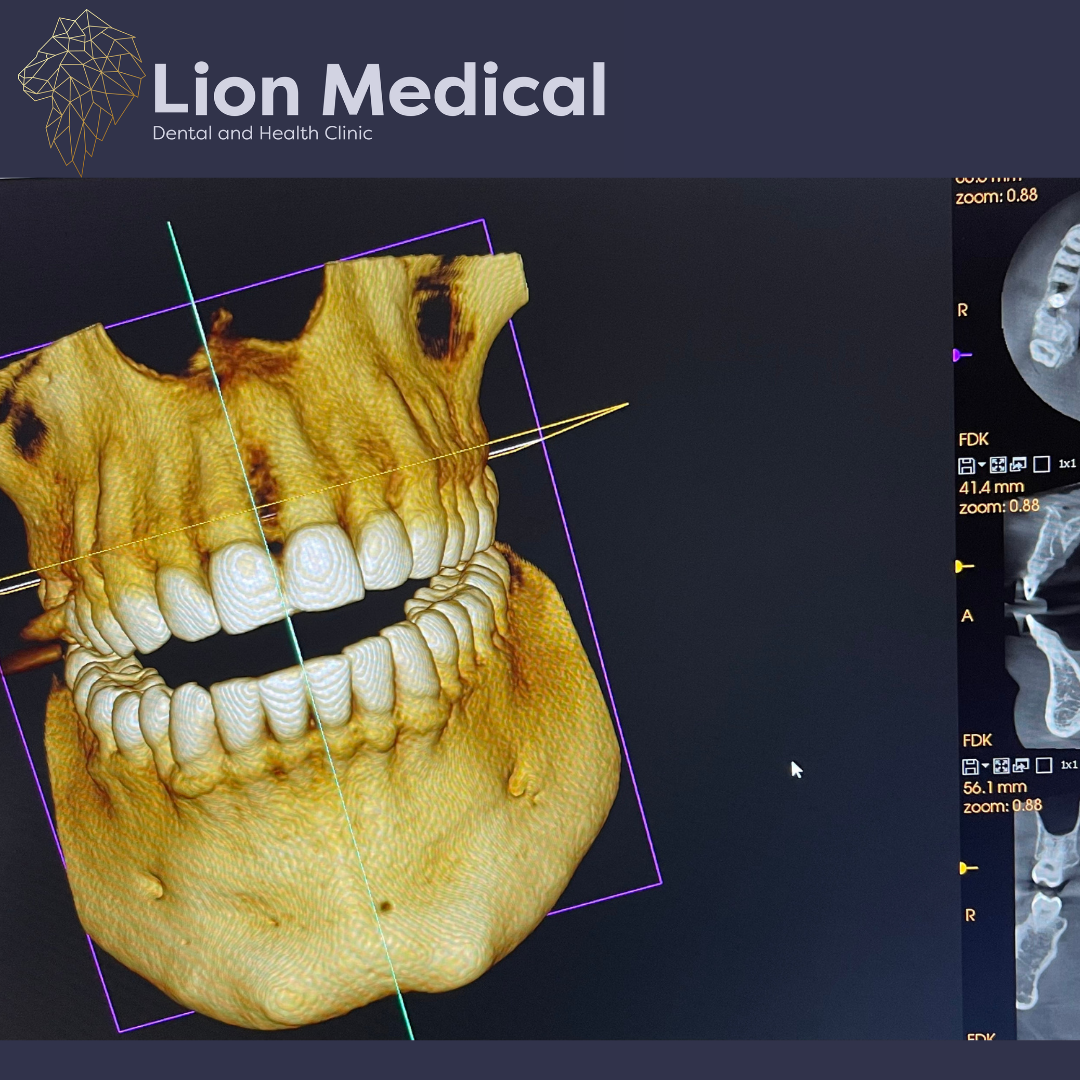 CT Scan CT Scan Lion Medical
